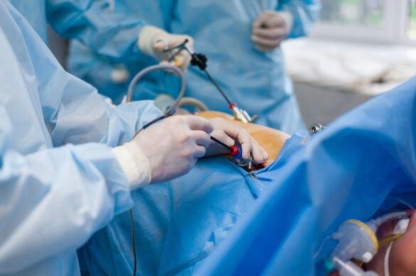 A un stade avancé de l'ostéochondrose du rachis lombaire, une intervention chirurgicale est nécessaire